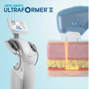 HIFU Ultraformer III 緊緻拉提 全面、眼、頸體驗療程