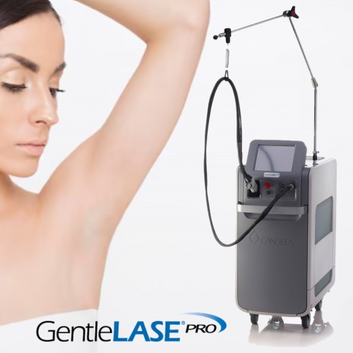 GentleLase Pro 755nm激光脫毛 腋下 單部位永久脫毛