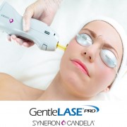 GentleLase Pro 755nm激光脫毛 面部/唇部 單部位永久脫毛